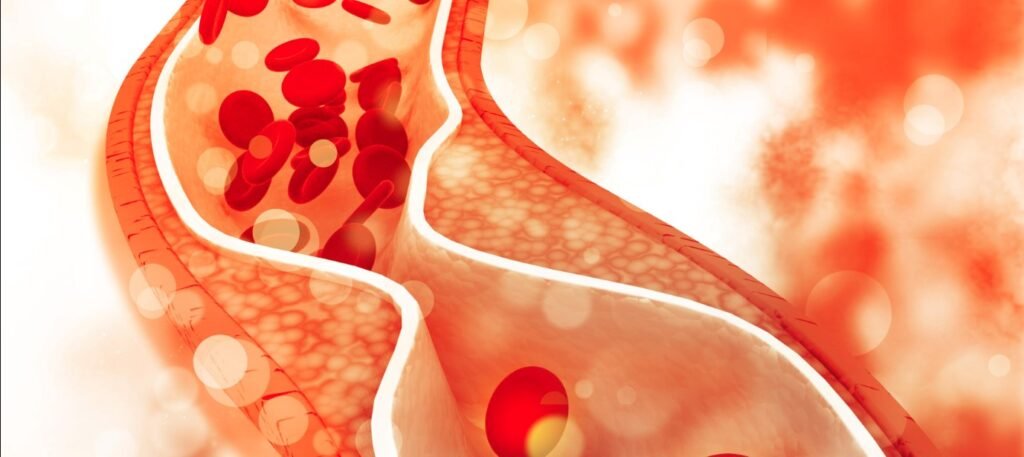 cholesterol.jpg